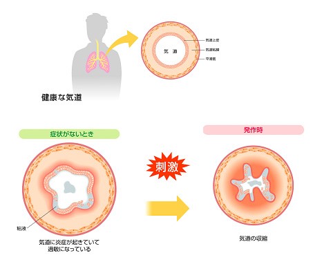 香水 トップ 咳